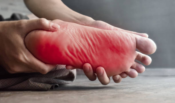 Close-up of an individual holding a foot marked with red spots, suggesting possible inflammation or rash.